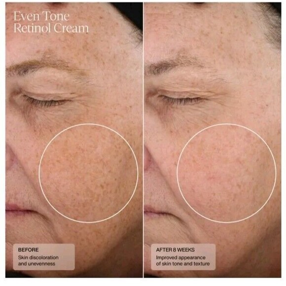 Sold_not For Sale Sente Even Tone Retinol Cream Full Size 1.0 fl oz/30ml - Picture 8 of 8